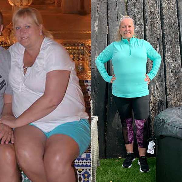 Sam Long weight loss transformation-losing 2st reduced diabetes risk-slimming world blog